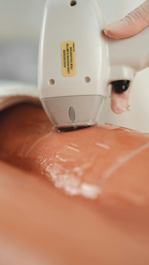 Pourquoi opter pour l'épilation laser du maillot sans douleur ?